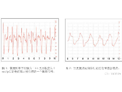 壓電薄膜傳感器在生命特征監(jiān)測方面應(yīng)用的解決方案